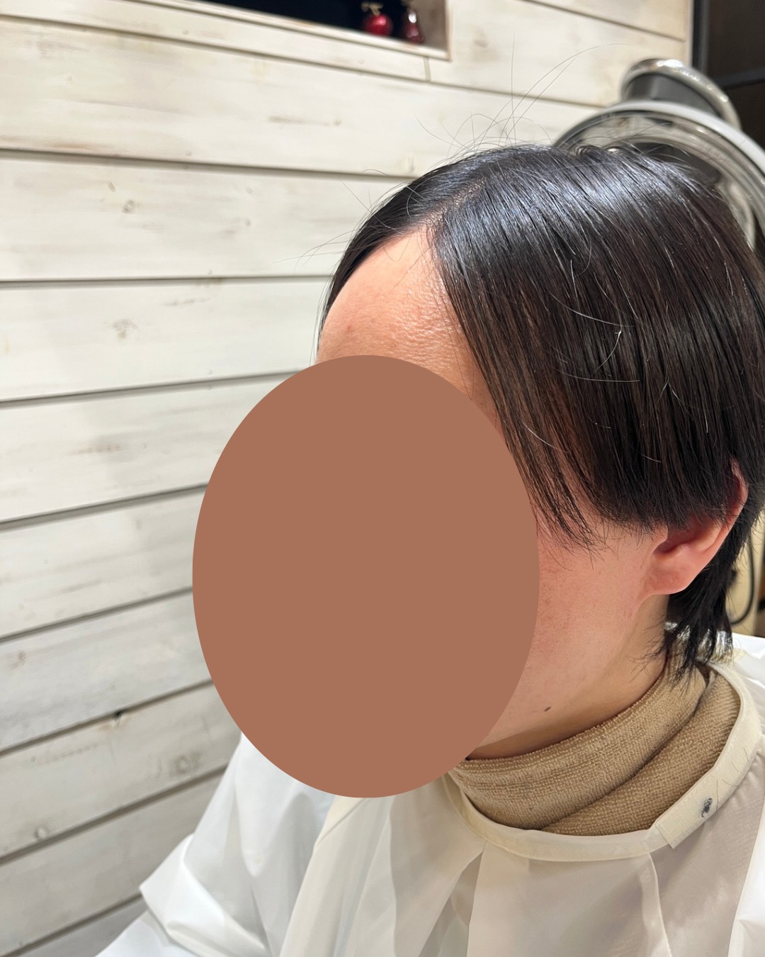 ウィッグ装着前（サイド）